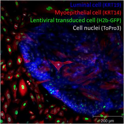 Lost in transduction: Critical considerations when using viral vectors